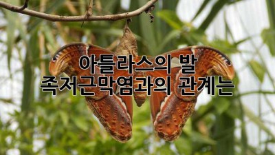 아틀라스의 발: 족저근막염과의 관계는?